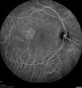 csr-chronic_davden_041819_27.jpg