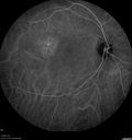 csr-chronic_davden_041819_28.jpg