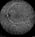 csr-chronic_davden_041819_29.jpg