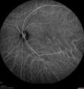 csr-chronic_davden_041819_30.jpg