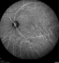 csr-chronic_davden_041819_31.jpg