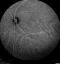 csr-chronic_davden_041819_32.jpg
