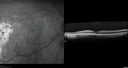 csr-testing-asymptomatic-goodva_281629.jpg