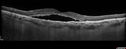 csr_arbr_022117_10.jpg
