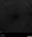 csr_fibrin21_mada_050117_13.jpg