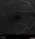 csr_fibrin21_mada_050117_14.jpg