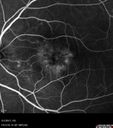 csr_fibrin21_mada_050117_24.jpg