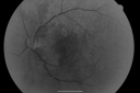 csrour_dast_28829.png