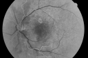 csrour_dast_28929.png