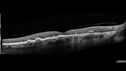 dryamd_licap_061022_07.jpg