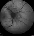 dystwhitespots_lori_faoct_01231202.jpg