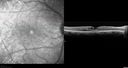dystwhitespots_lori_faoct_01231205.jpg