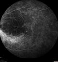dystwhitespots_lori_faoct_01231226.jpg