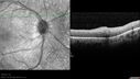 dystwhitespots_lori_oct_02201229.jpg