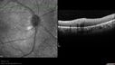dystwhitespots_lori_oct_02201230.jpg