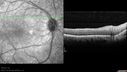 dystwhitespots_lori_oct_02201231.jpg