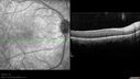 dystwhitespots_lori_oct_02201232.jpg