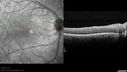 dystwhitespots_lori_oct_02201235.jpg