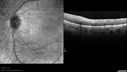 dystwhitespots_lori_oct_02201239.jpg