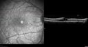 dystwhitespots_lori_oct_06071240.jpg