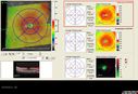 dystwhitespots_lori_oct_10181244.jpg