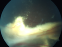 fevr_gasa_05.png