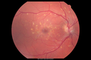 flavimacul_pama_031314_01.png
