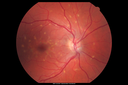 flavimacul_pama_031314_02.png