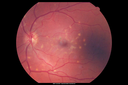 flavimacul_pama_031314_03.png