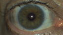 fuchs_heterochromia_maduf_02.png