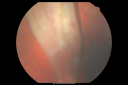 funnelrd_phba03.png