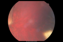 funnelrd_phba06.png