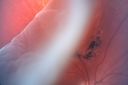Filename=giantdialysisrd_masc05.jpg
Filesize=618KiB
Dimensions=1200x800
Date added=Jan 17, 2012 giantdialysisrd_masc05.jpg