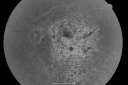 gunshottohead_elbe18.png
