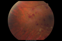 hairycell_frno_100115_03.png