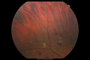 hairycell_frno_100115_04.png