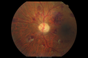 hairycell_frno_100115_07.png