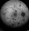 hairycell_frno_100115_11.jpg