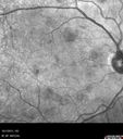 hairycell_frno_100115_13.jpg