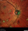 hairycell_frno_100115_16.jpg
