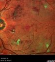 hairycell_frno_100115_17.jpg