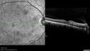 hairycell_frno_100115_19.jpg
