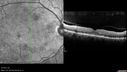 hairycell_frno_100115_20.jpg