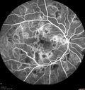 hairycell_frno_100115_28.jpg