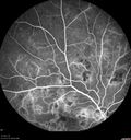 hairycell_frno_100115_29.jpg