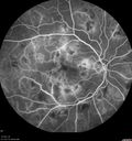 hairycell_frno_100115_31.jpg