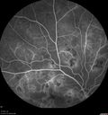 hairycell_frno_100115_33.jpg