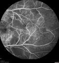 hairycell_frno_100115_38.jpg