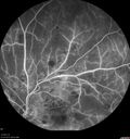 hairycell_frno_100115_39.jpg
