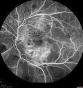 hairycell_frno_100115_41.jpg